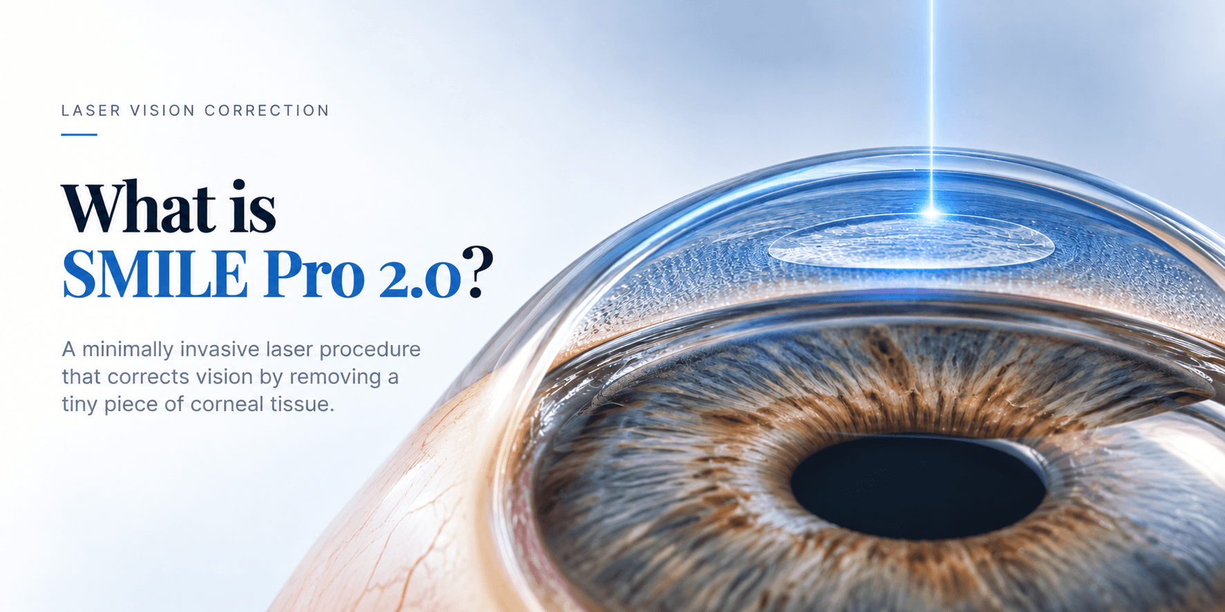 What is SMILE Pro 2.0?